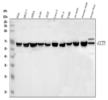 Anti-TCP1 epsilon/CCT5 Antibody