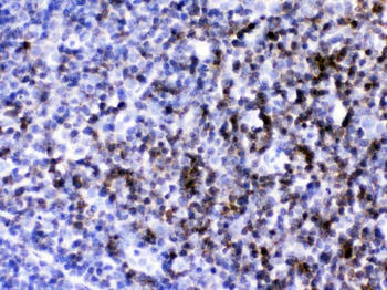 CD2/CD2 Rabbit Polyclonal Antibody