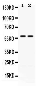 Anti-CD2/CD2 Antibody
