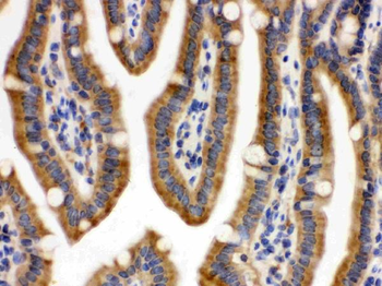 Anti-CDCP1 Antibody