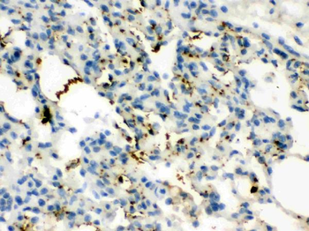 Anti-Calcitonin/CALCA Antibody