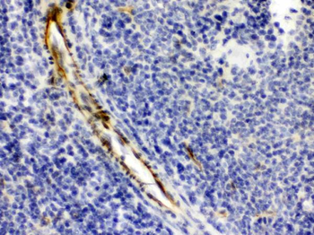 Anti-Alpha A Crystallin/CRYAA Antibody