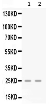 GRO gamma/CXCL3 Antibody