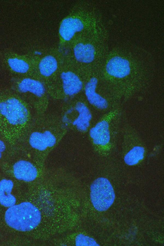 Intestinal FABP/FABP2 Antibody