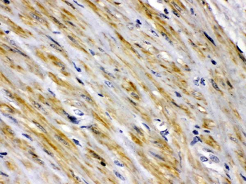 Anti-Intestinal FABP/FABP2 Antibody