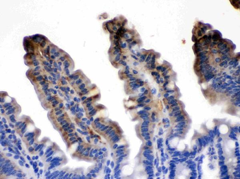 Anti-Intestinal FABP/FABP2 Antibody