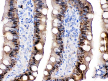 Anti-Intestinal FABP/FABP2 Antibody