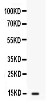 Anti-Intestinal FABP/FABP2 Antibody