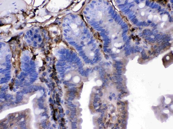 Anti-FGF1 Antibody