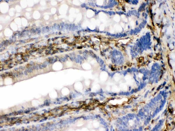 Anti-FGF1 Antibody