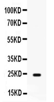 Anti-FGF1 Antibody