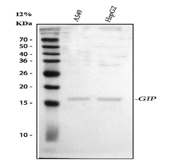 GIP Rabbit Polyclonal Antibody