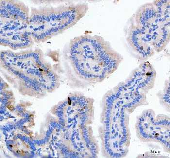 GIP Rabbit Polyclonal Antibody