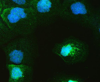 Anti-GAL4/LGALS4 Antibody