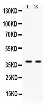 Anti-GAL4/LGALS4 Antibody