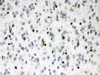 Anti-MEF2A Antibody