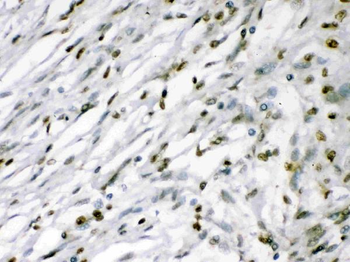 Anti-MEF2A Antibody