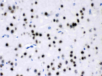 Anti-MEF2A Antibody