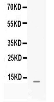 Anti-MGP Antibody