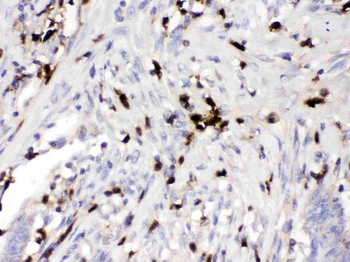 Alpha 1 Acid Glycoprotein/ORM1 Rabbit Polyclonal Antibody