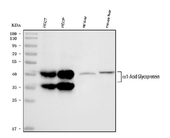 Anti-Alpha 1 Acid Glycoprotein/ORM1 Antibody
