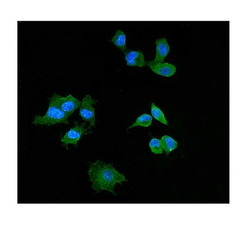Anti-Elafin/Skalp/PI3 Antibody
