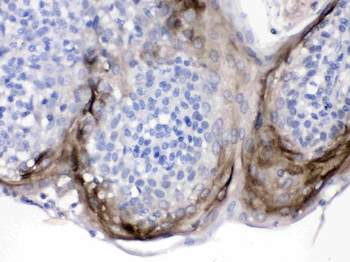 Anti-Elafin/Skalp/PI3 Antibody