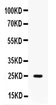 Anti-Elafin/Skalp/PI3 Antibody