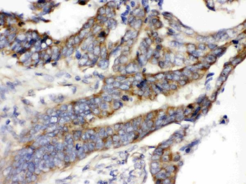 Anti-Glucose Transporter 5 GLUT5/SLC2A5 Antibody