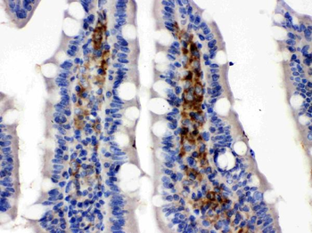 Anti-Glucose Transporter 5 GLUT5/SLC2A5 Antibody
