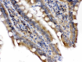 Talin 2/TLN2 Antibody