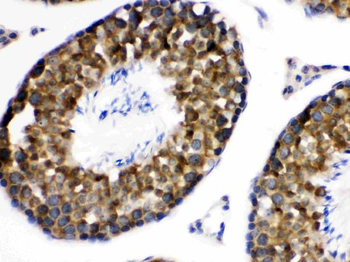 Anti-WNK1 Antibody