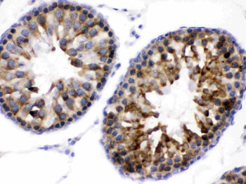Anti-WNK1 Antibody
