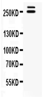 Anti-WNK1 Antibody