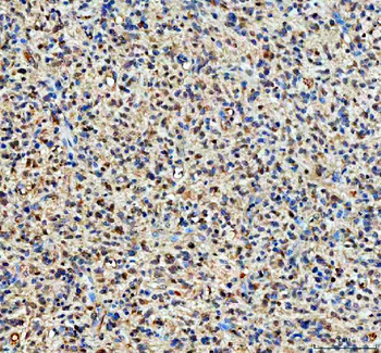 Anti-YAP1 Antibody