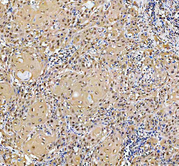 Anti-YAP1 Antibody