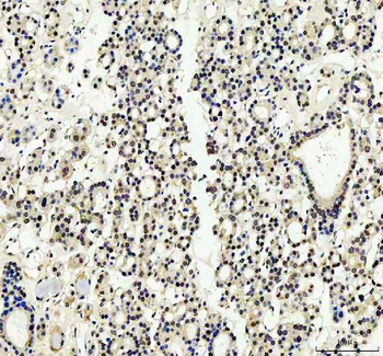 Anti-YAP1 Antibody