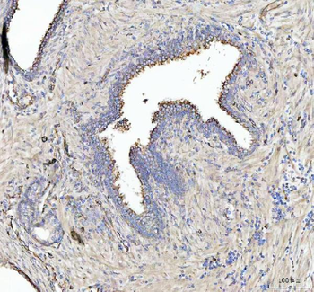 ZAP70 Rabbit Polyclonal Antibody