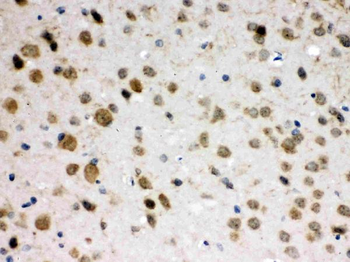 Anti-ABR Antibody
