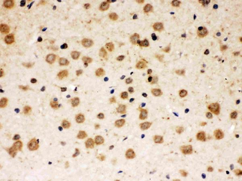 Anti-ABR Antibody