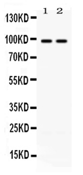 Anti-ABR Antibody