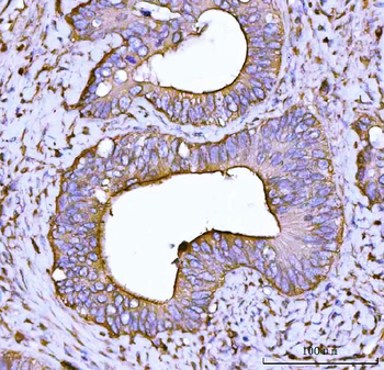 Anti-Alpha Actinin 4/ACTN4 Antibody