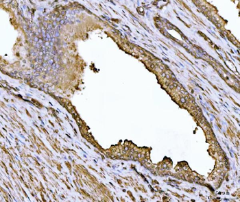 Anti-Alpha Actinin 4/ACTN4 Antibody