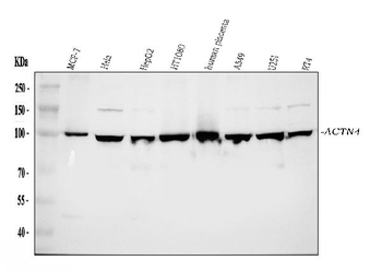 Anti-Alpha Actinin 4/ACTN4 Antibody