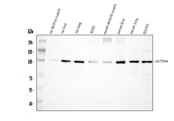 Anti-Alpha Actinin 4/ACTN4 Antibody