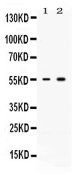 Activin Receptor Type IIB/ACVR2B Rabbit Polyclonal Antibody