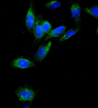 Anti-AEBP2 Antibody