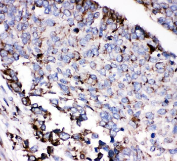 Anti-AEBP2 Antibody