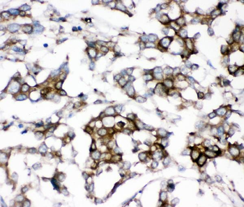Anti-AEBP2 Antibody