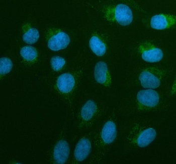 Anti-AIRE Antibody